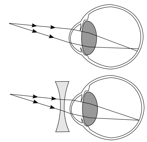 Lentes esféricas tipos características e usos